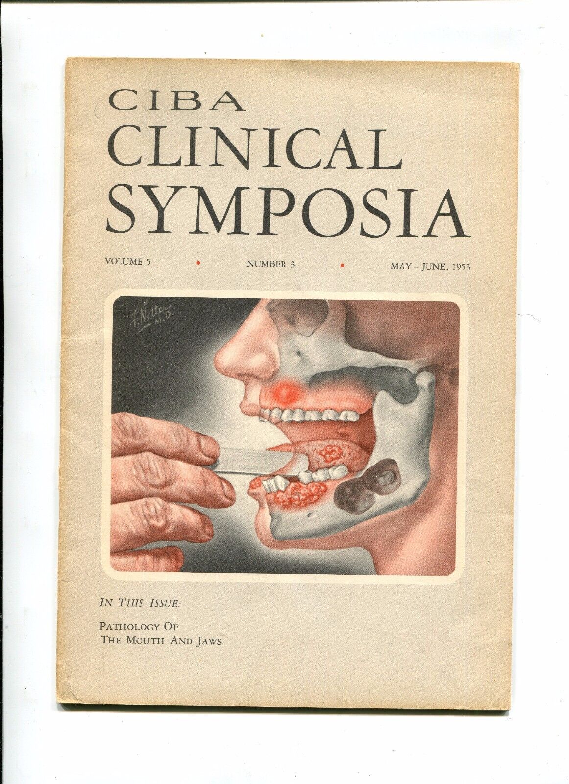 Vintage Medical Magazine CIBA CLINICAL SYMPOSIA May/Jun 1953 Dr Netter illus