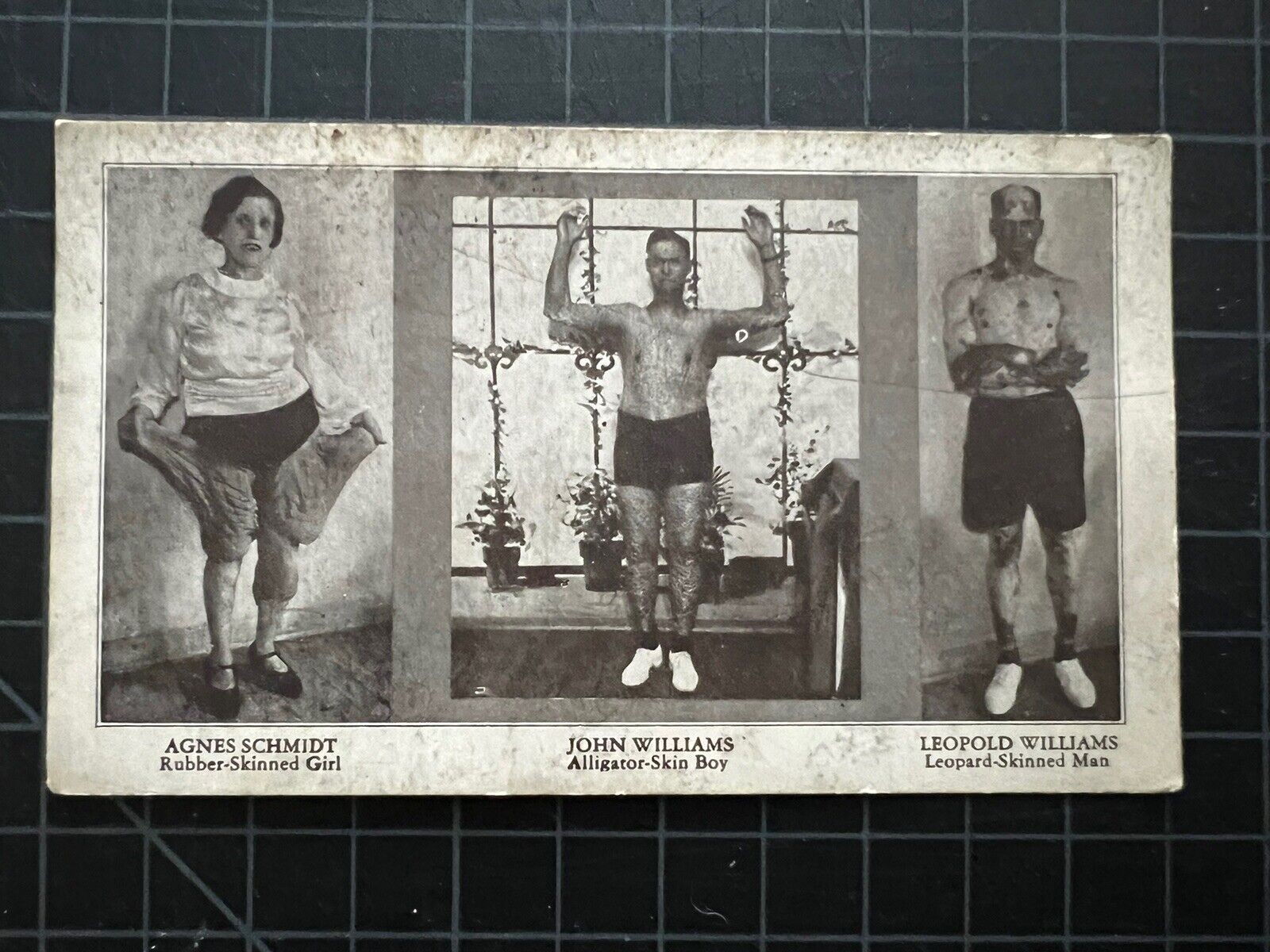 Vintage Ripleys Odditorium- Skin Disorders Postcard - Oddity Circus Freak