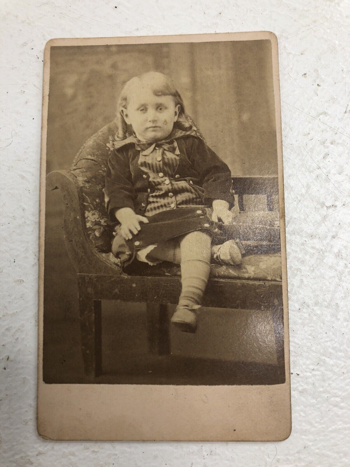 Vintage Antique CDV Of Child With Dwarfism/little Person  3.75”