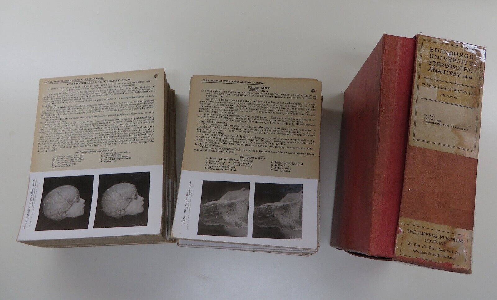 Antique Stereoscopic Lot Of 88 Edinburgh  Anatomy Cards Early 1900’s In Box