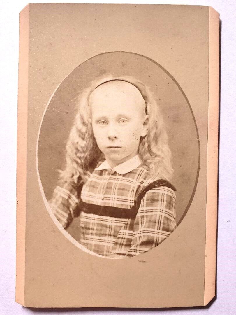 Antique 1870s CDV Photo Pretty ALBINO Girl Circus Sideshow Freak Brunswick Maine