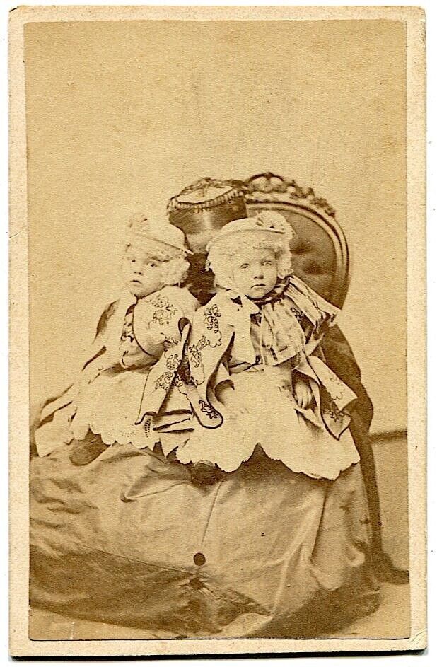 Carter Siamese Twins with Hidden Mother 1860s Roxbury Massachusetts CDV Photo