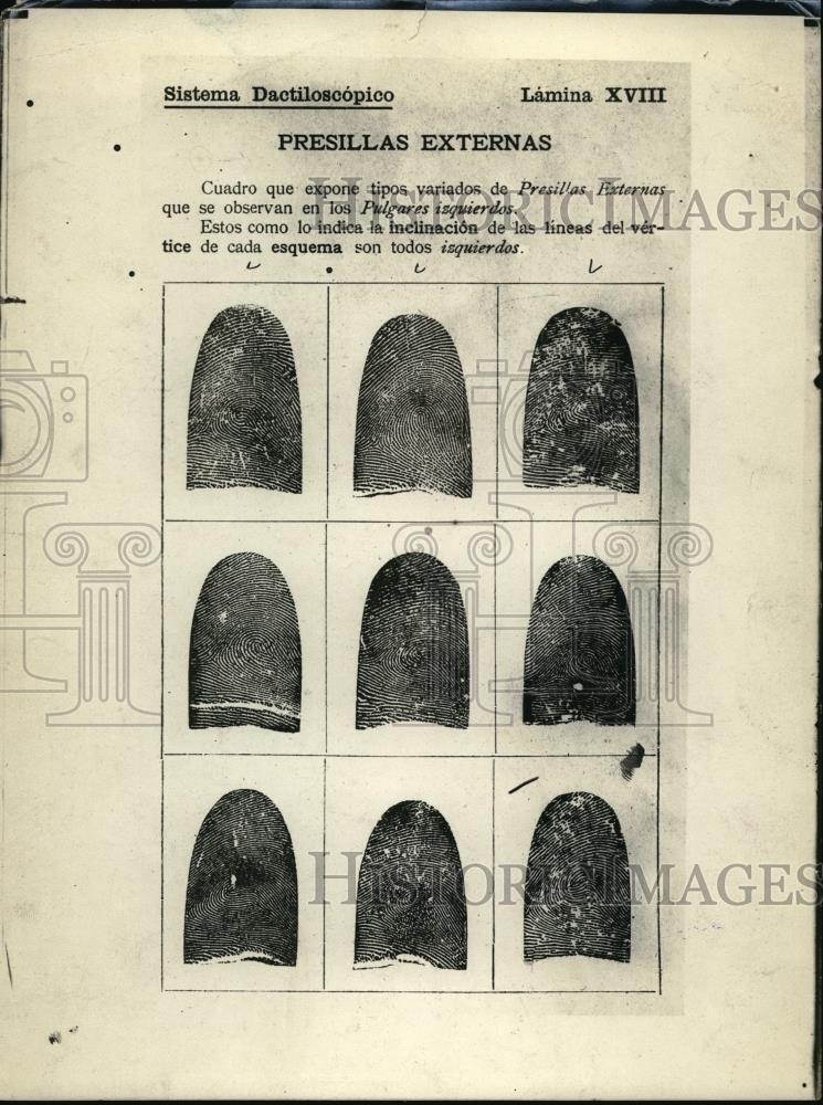 1914 Press Photo various Fingerprints of what is called Vucrtich external body