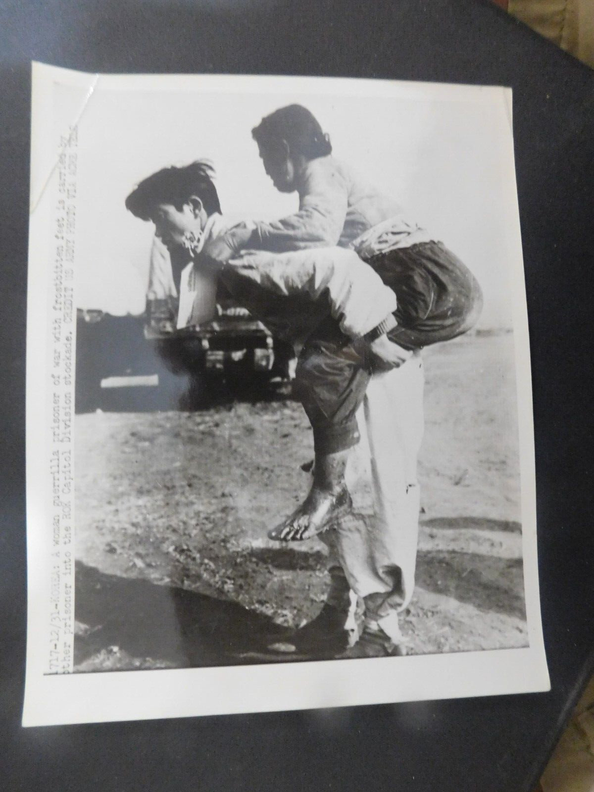 1951 KOREAN WAR ACME PRESS PHOTO WOMAN GUERRILLA POW FROSTBITTEN FEET ROK 9X7