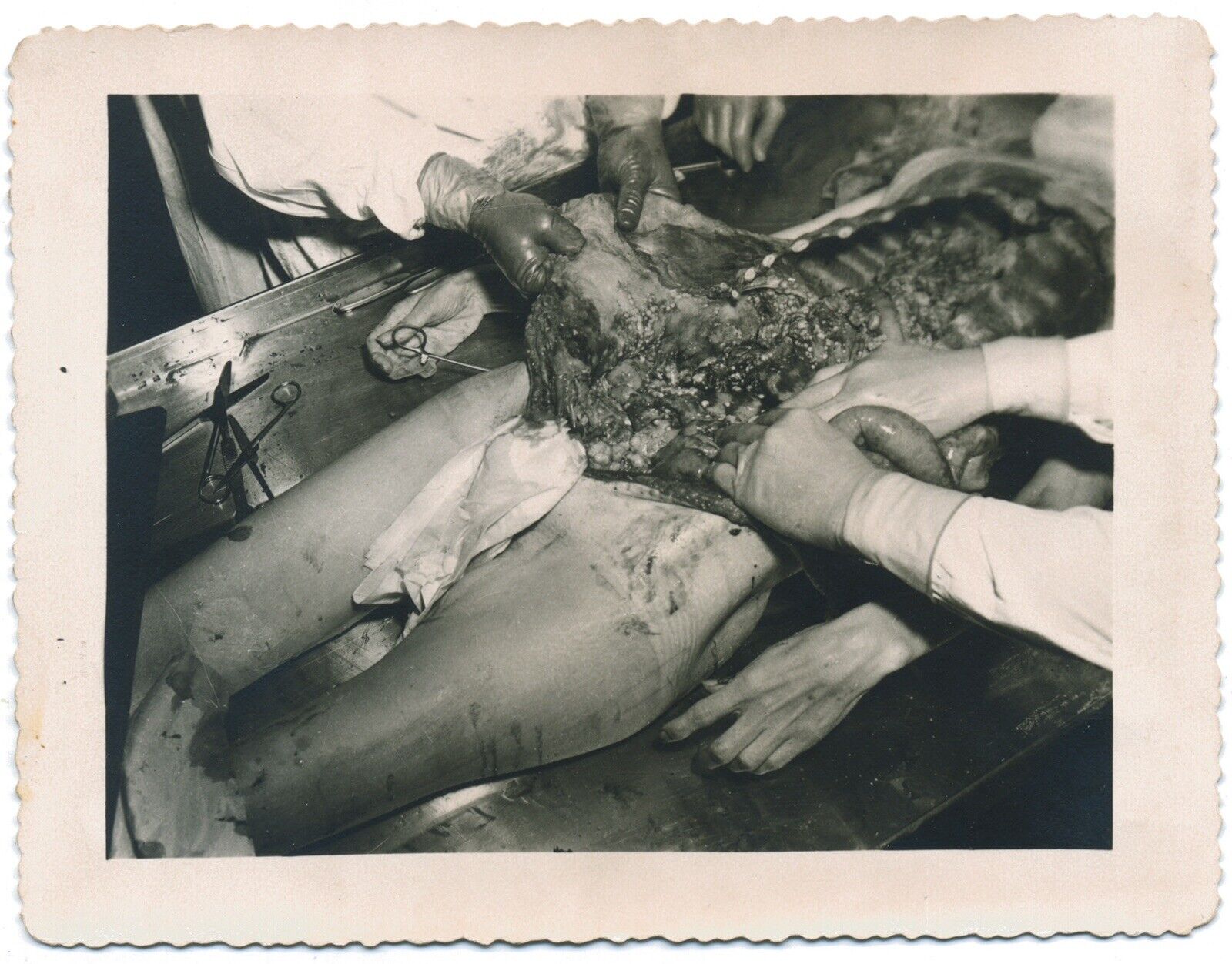 RARE WW2 Medical Dissection Autopsy Photograph Japanese Cadaver Historic 1942