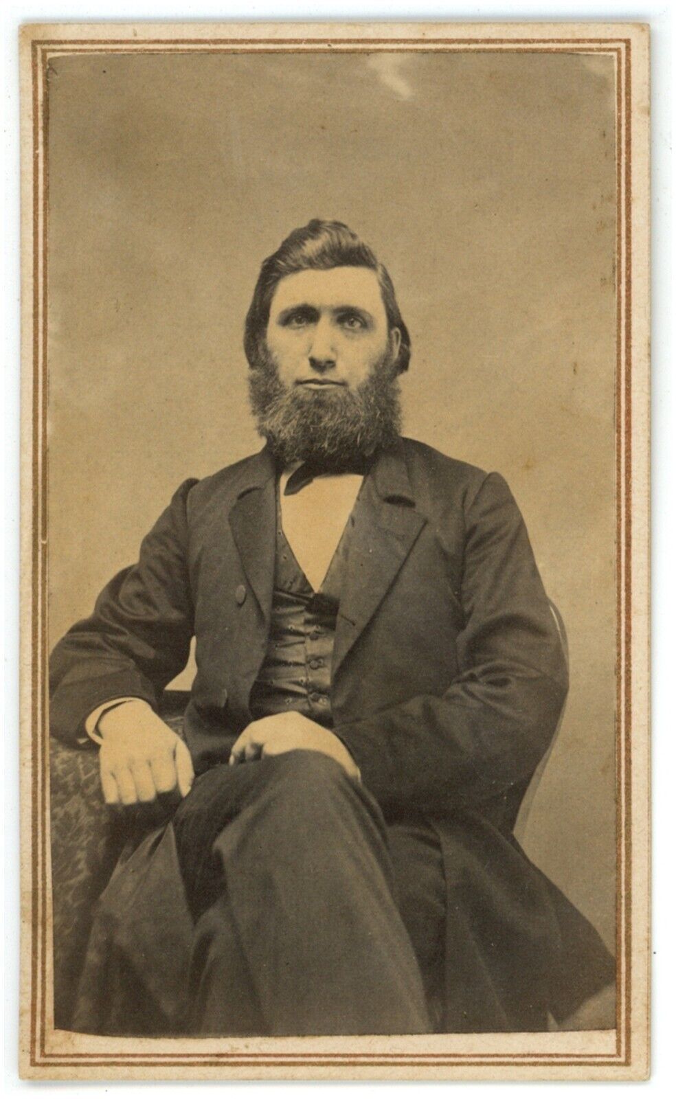CIRCA 1860\'S CDV Featuring Interesting Looking man With Full Chin Beard in Suit