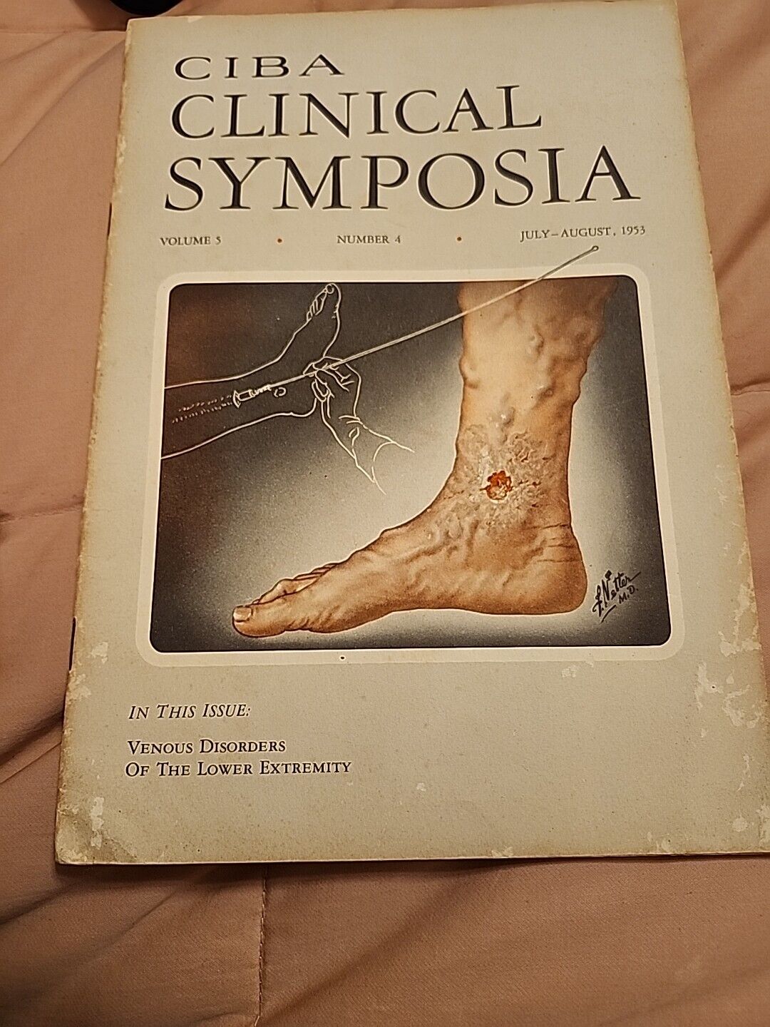 ciba clinical symposia July /August 1953