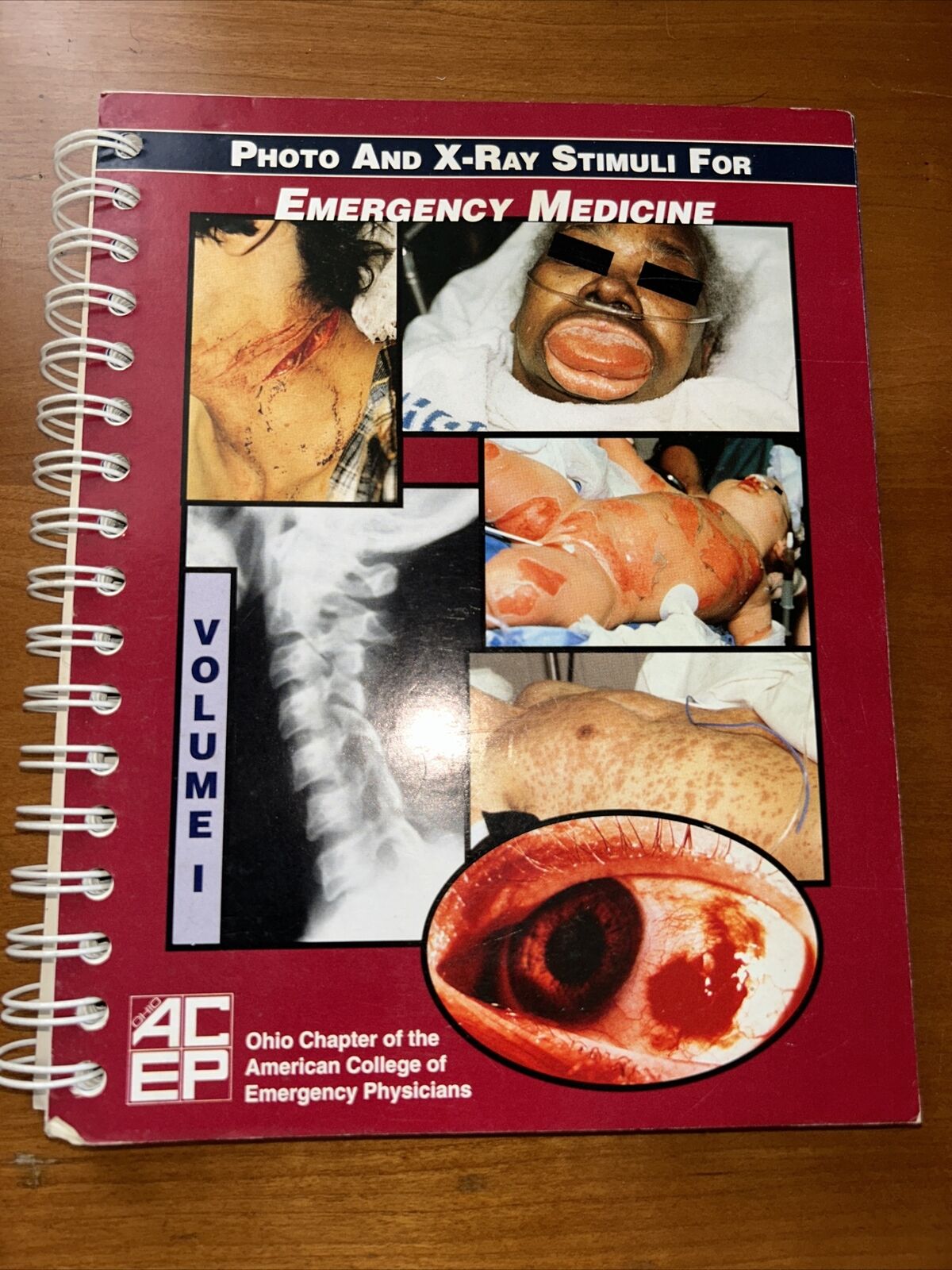 Photo and X-Ray Stimuli by Emergency Medicine ACEP VOLUME 1 F10