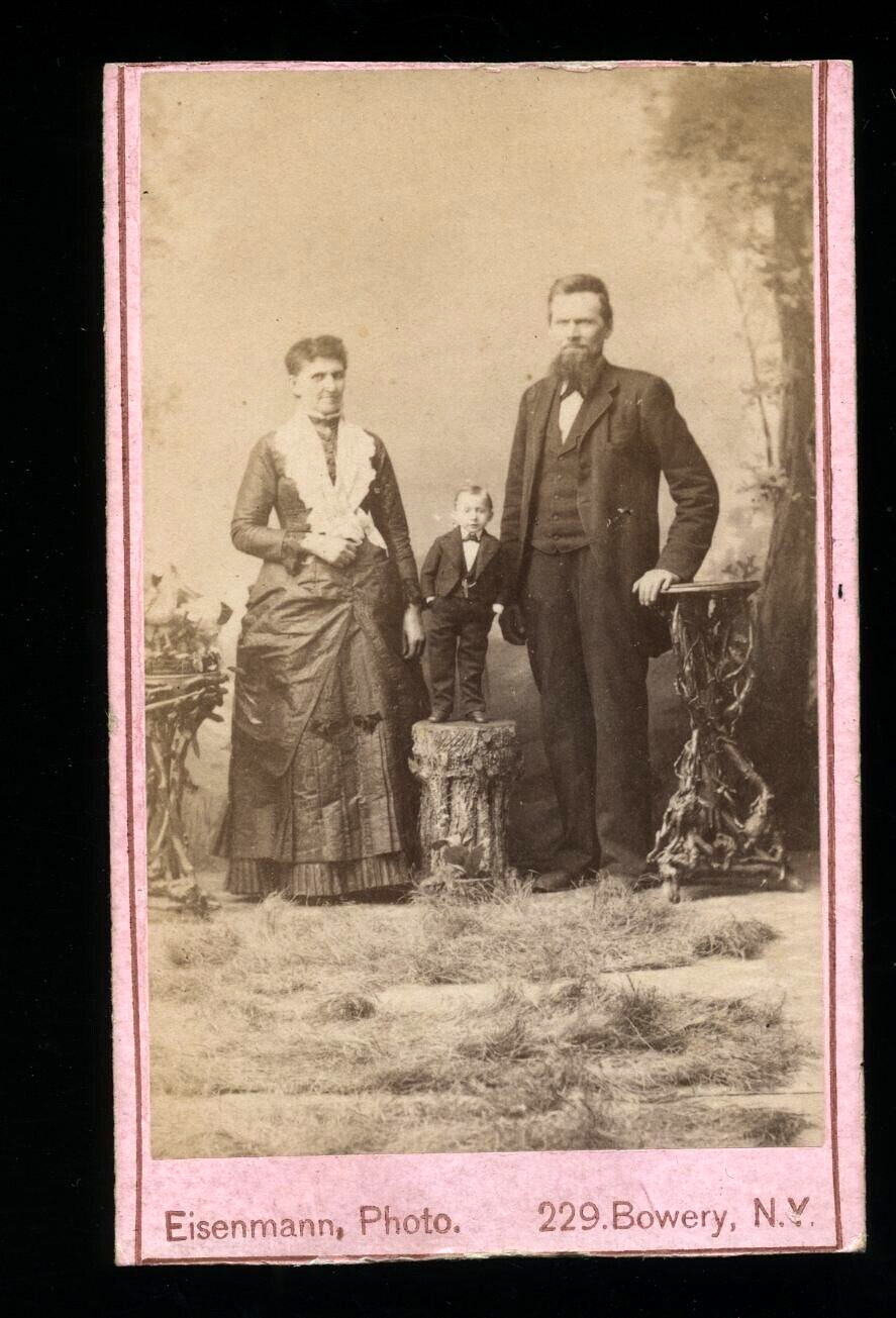 1870\'S DUDLEY FOSTER CIRCUS FREAK CHARLES EISENMANN ANTIQUE CDV PHOTO