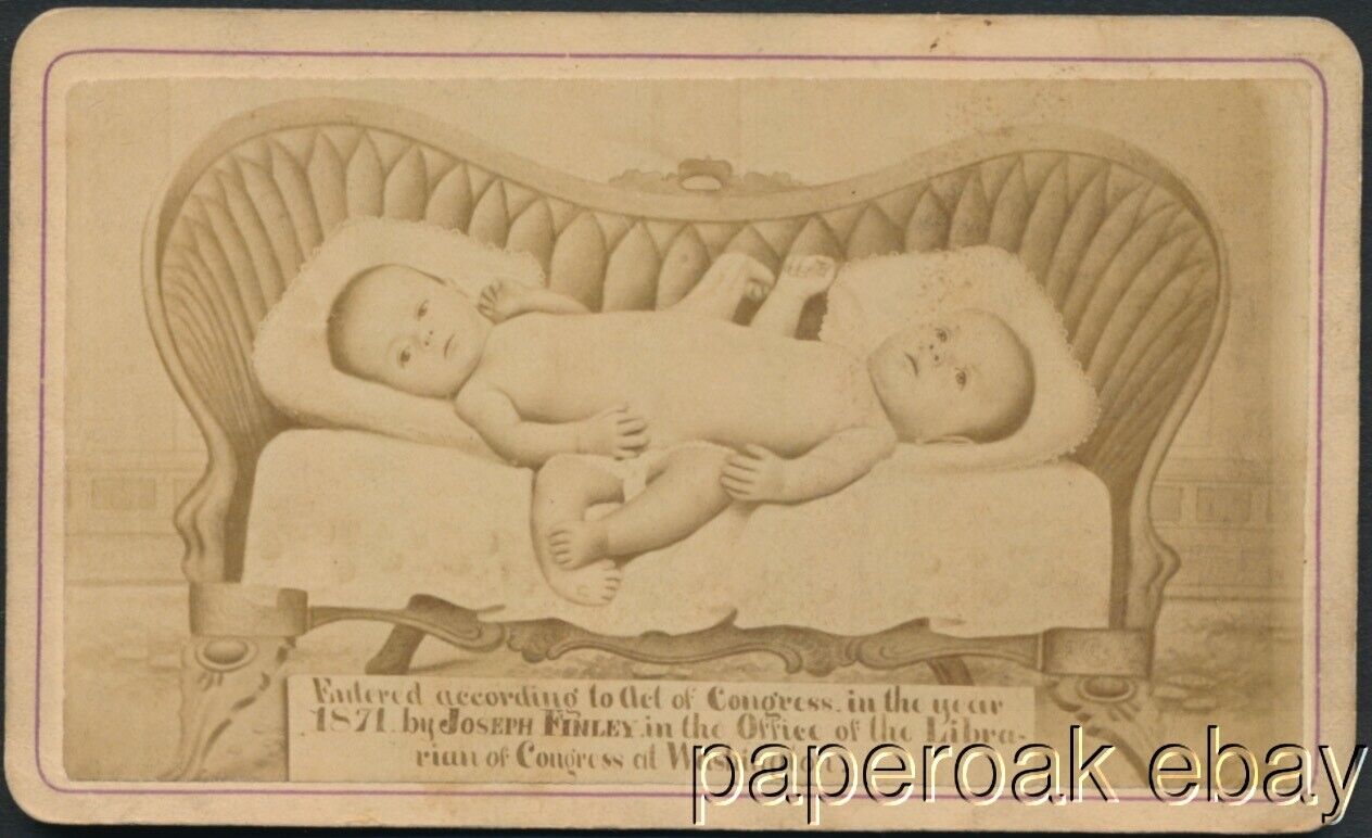 Original 1871 Carte De Visite Photo Of Conjoined Twin Babies