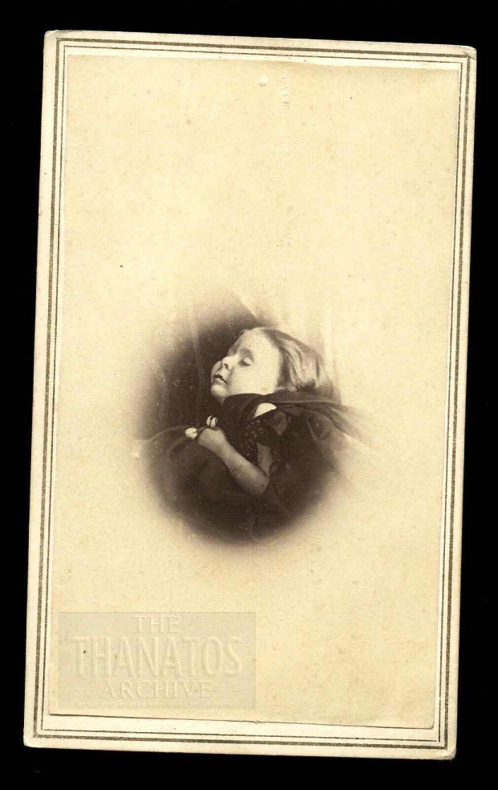 Thin Girl, Post Mortem CDV Photo, Vignette, 1860s