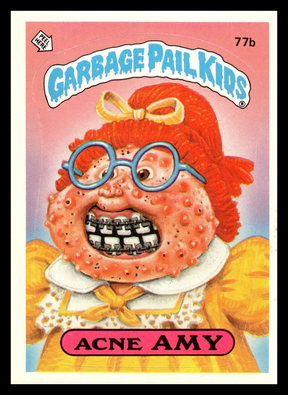 1985 Topps Garbage Pail Kids Series 2 Acne Amy 77b GLOSSY BACK PUZZLE