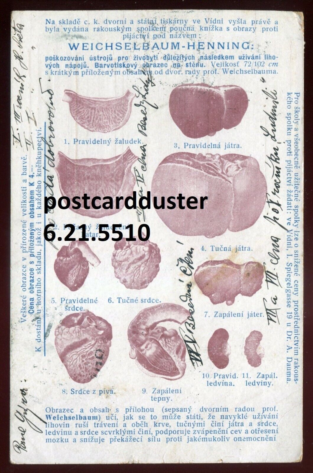 Austria / CZECHIA Postcard 1905 Temperance Organ Disease Illustrations. Medical
