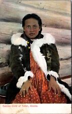 Postcard Eskimo Child of Teller, Alaska Yukon Pacific Exposition picture