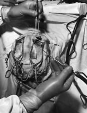 Vintage Medical Lobotomy Photo 490 Oddleys Strange & Bizarre picture