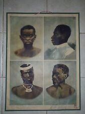 Original vintage medical pull down school chart the human race  picture