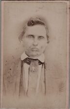 Antique CDV Photo Glassy Eyed Gentleman Carte de visite 1870s picture