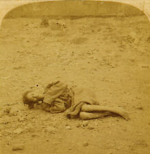 Underwood Stereoview Chinese Man Waiting to Die: in Dying Field of Canton, China picture