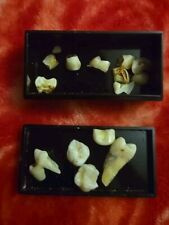 Human Tooth Lot - What You See Is What You Get picture