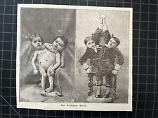 Vintage Etching - Siamese Twins Tocci Bros. - Circus Oddity Freak Sideshow picture