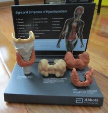 Vintage Promotional Thyroid model by Abbott Laboratories, 2008 picture