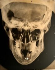 Rare Large 10” Antique Glass X-ray Photographic Plate C1900 Skull Medical Photo picture