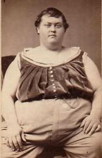 BEAUTIFUL Antique FREAK PHOTO Rare Historic CIRCUS FAT MAN 1870 Sideshow History picture
