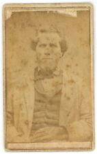 Antique CDV Circa 1860'S Rugged Man With Beard & Hollow Eyes Wearing Suit & Tie picture