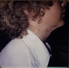 Vintage Photo Slide 1976 Young Man Post Operation Neck Scar picture