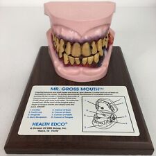Mr. Gross Mouth from Health Edco Mouth Hinged Model picture