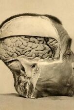 Antique Medical Brain Specimen Photo 174b Oddleys Strange & Bizarre picture