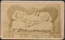 Original 1871 Carte De Visite Photo Of Conjoined Twin Babies picture