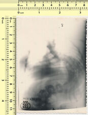 160 Radiography Deformity X-Ray Abstract Surreal Spine Bones vintage photo orig. picture