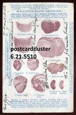 Austria / CZECHIA Postcard 1905 Temperance Organ Disease Illustrations. Medical picture